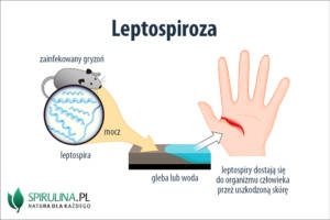 Leptospiroza