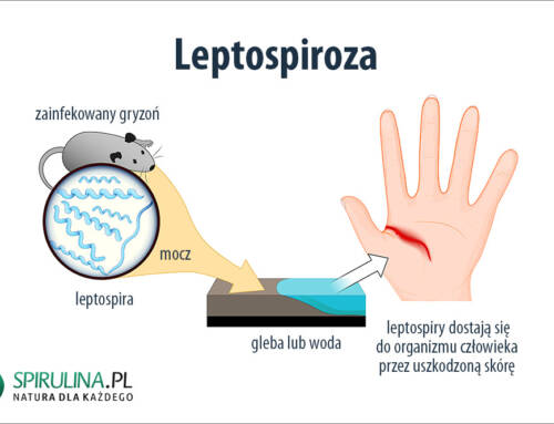 Leptospiroza