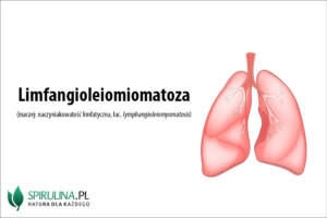 Limfangioleiomiomatoza