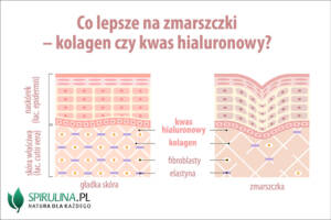 Co lepsze na zmarszczki – kolagen czy kwas hialuronowy? 