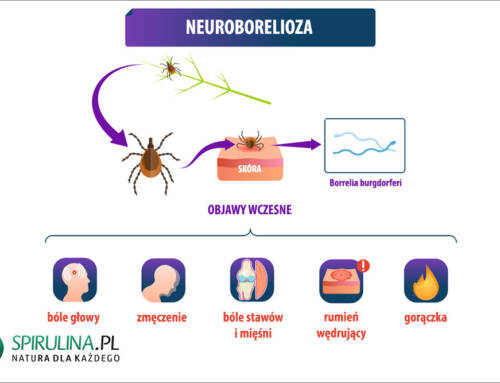 Neuroborelioza