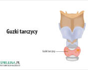 Guzki tarczycy