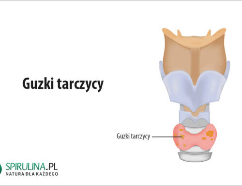 Guzki tarczycy