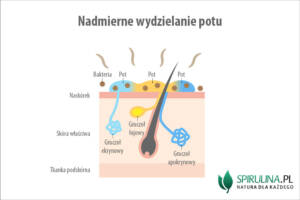 Nadmierne wydzielanie potu