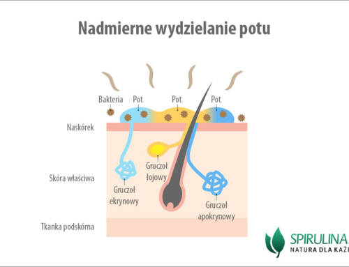 Nadmierne wydzielanie potu