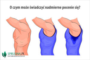 O czym może świadczyć nadmierne pocenie się?