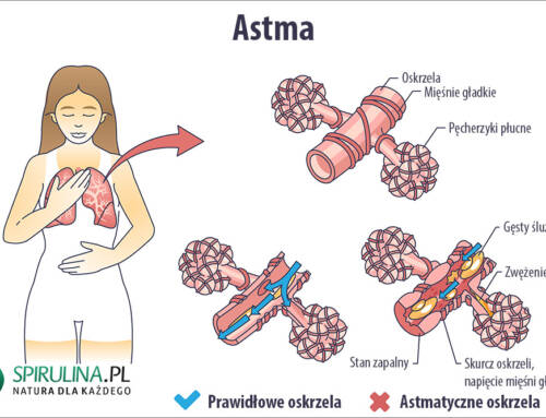 Astma